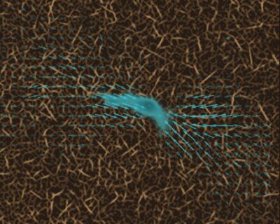 The image shows matrix deformation (arrows) around an NK92 immune cell during its migration through 3D collagen gel. Image: FAU